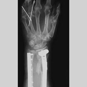 Arm and Finger Repair - Art Print