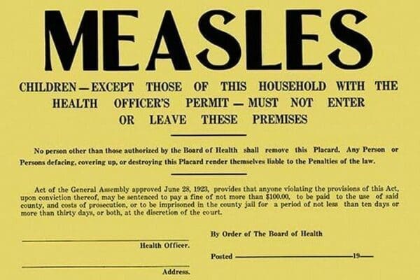 Measles - Art Print