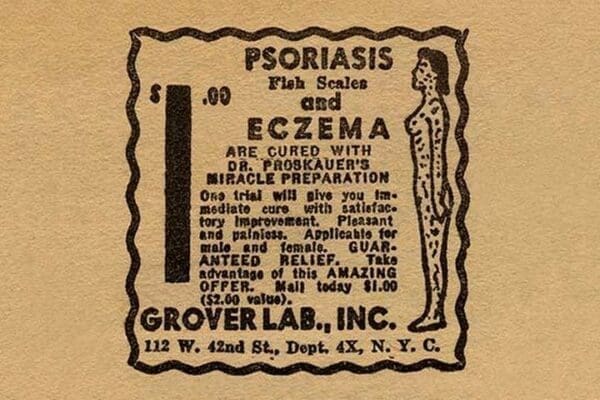 Psoriasis