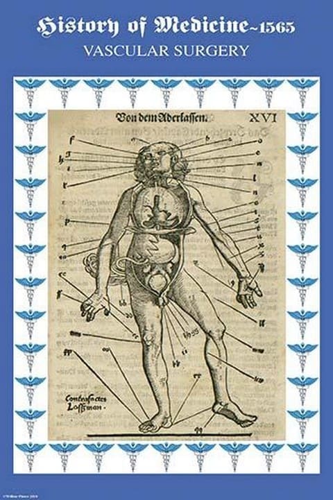 Vascular Surgery by Paracelsus - Art Print